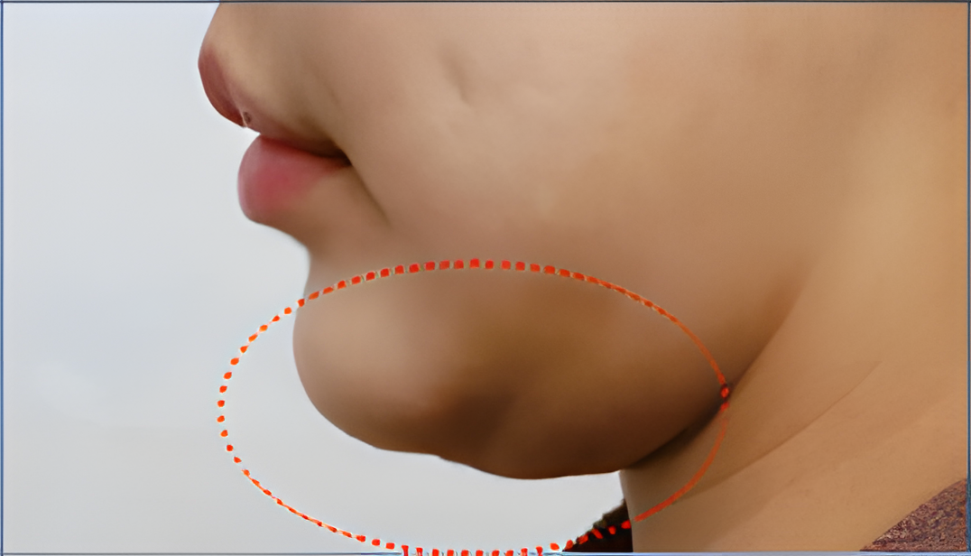 image comparison before