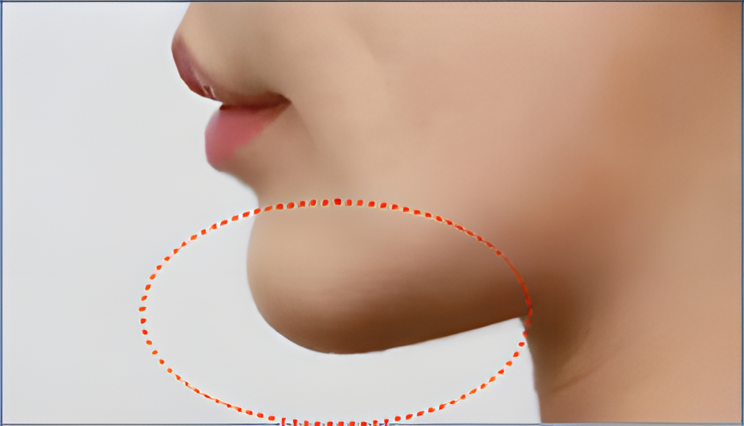 image comparison after