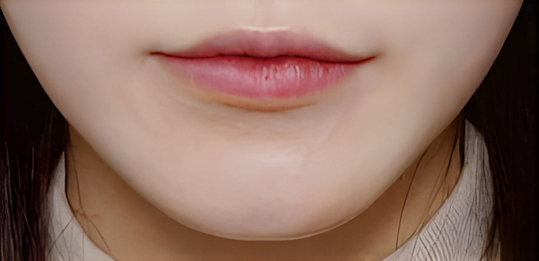 image comparison before