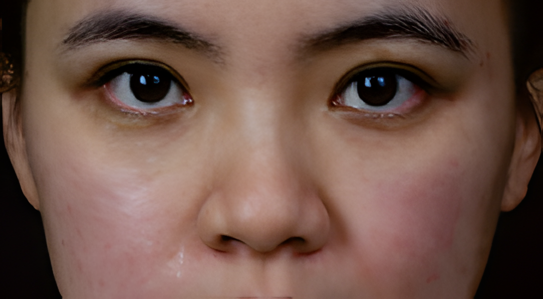 image comparison after